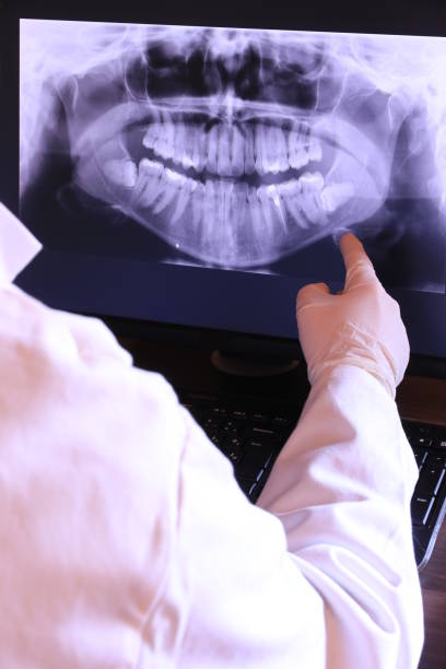 Best Broken or Chipped Tooth Repair in Kennewick, WA
